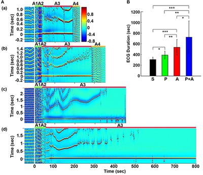 Adrenergic Blockade Bi-directionally and Asymmetrically Alters Functional Brain-Heart Communication and Prolongs Electrical Activities of the Brain and Heart during Asphyxic Cardiac Arrest